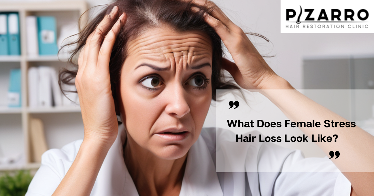 female stress hair loss pattern orlando fl